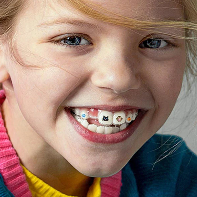 A young girl smiling brightly, showing off her traditional metal braces with colorful rubber bands.
